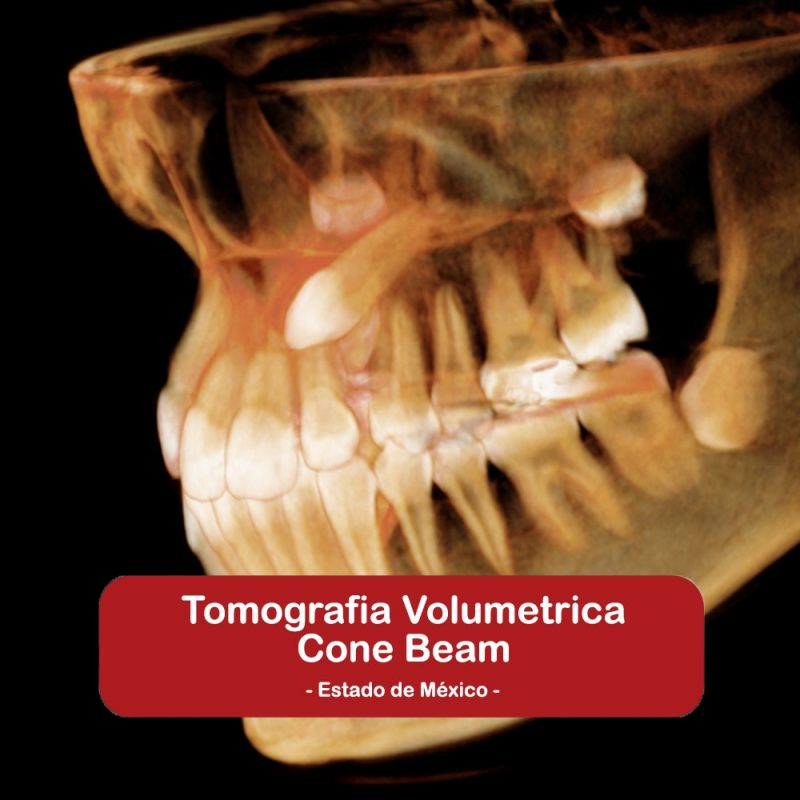 Tomografía Volumétrica Cone Beam