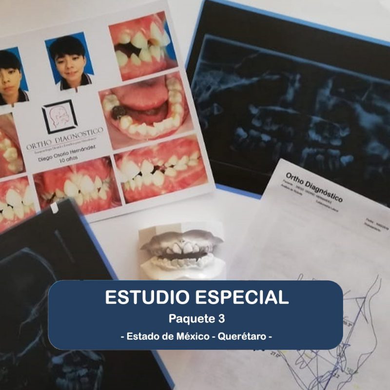 Estudio Especial