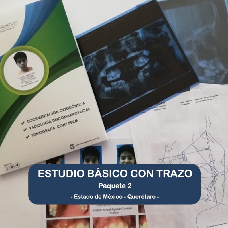 Estudio Básico con Trazo Digital