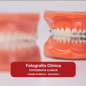 Fotografía Clínica