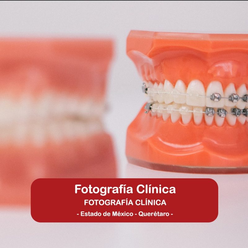 Fotografía Clínica
