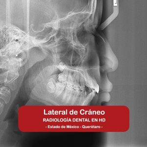 Lateral de Cráneo