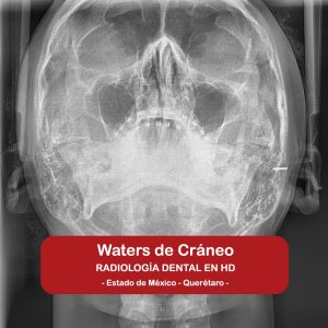 Waters de Cráneo