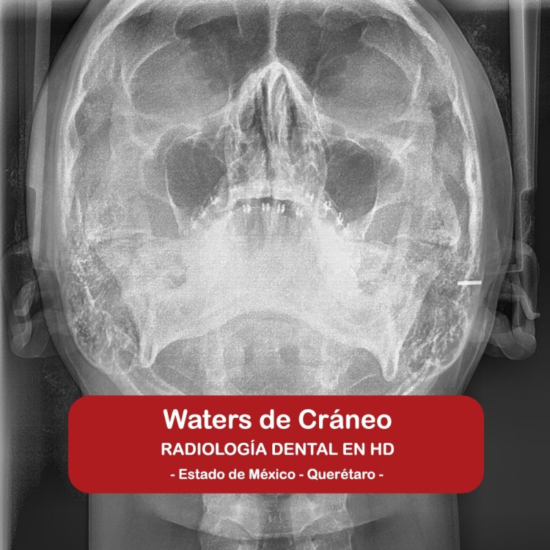 Waters de Cráneo