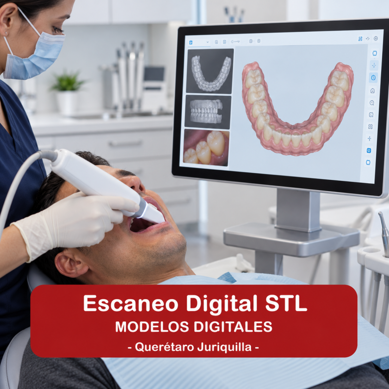 Escaneo o modelo digital STL