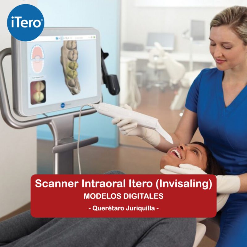 Scanner intraoral Itero (Invisaling)