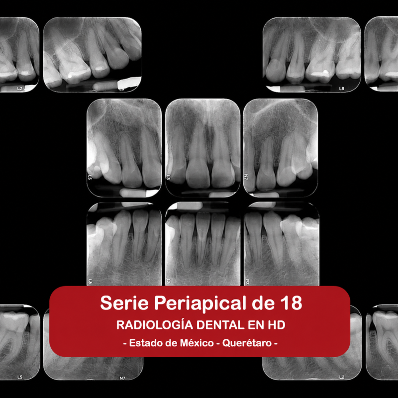 Serie Periapical de 18