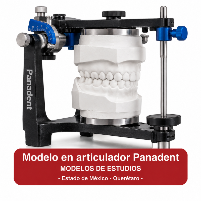 Modelo en articulador Panadent